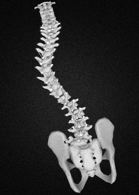 3D spine